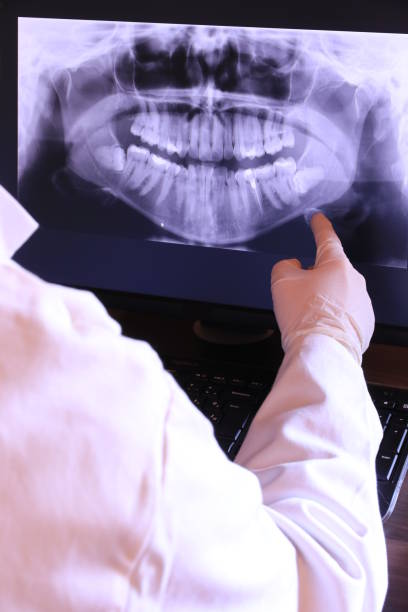 Best Tooth Infection Emergency Dentist  in Social Circle, GA
