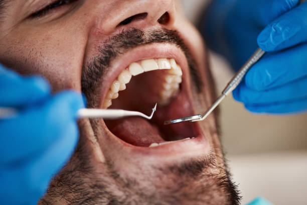 Best Broken Tooth Emergency  in Social Circle, GA